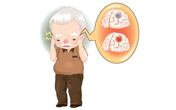 老人发呆流口水 可能快脑梗了